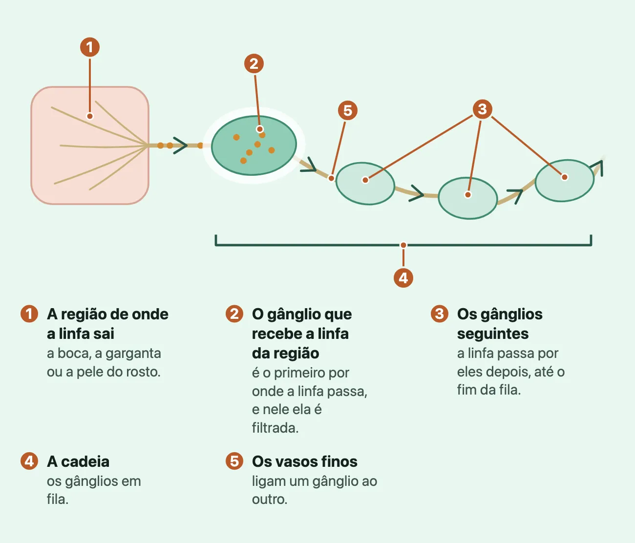 Esquema de uma cadeia de gânglios: à esquerda, um cartão rosado com vasos finos, a região de onde a linfa sai; um vaso leva a linfa, com pontinhos, até o primeiro gânglio, maior e realçado, onde os pontinhos ficam; dele o vaso segue por mais três gânglios em fila e some depois do último.