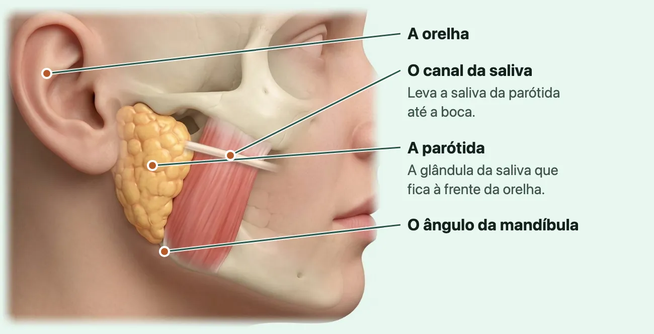 Ilustração do lado direito do rosto, de perfil, com a pele transparente: a parótida, uma glândula amarela à frente e abaixo da orelha, descendo até perto do ângulo da mandíbula, e o canal da saliva saindo dela para a frente, por cima do músculo da mastigação.