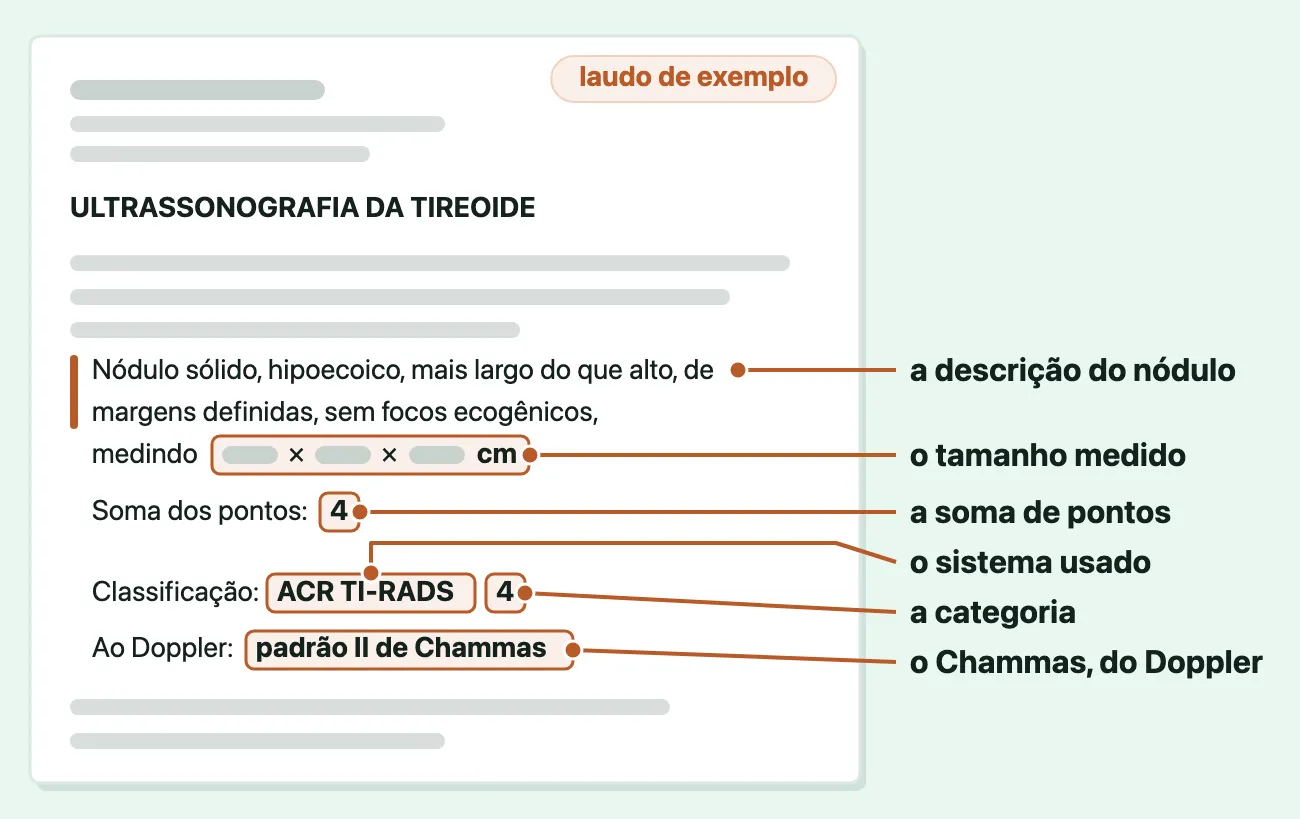 Trecho de um laudo de ultrassom de tireoide de exemplo com seis partes marcadas: a descrição do nódulo, o tamanho em centímetros, a soma de 4 pontos, o sistema ACR TI-RADS, a categoria 4 e o padrão II de Chammas.