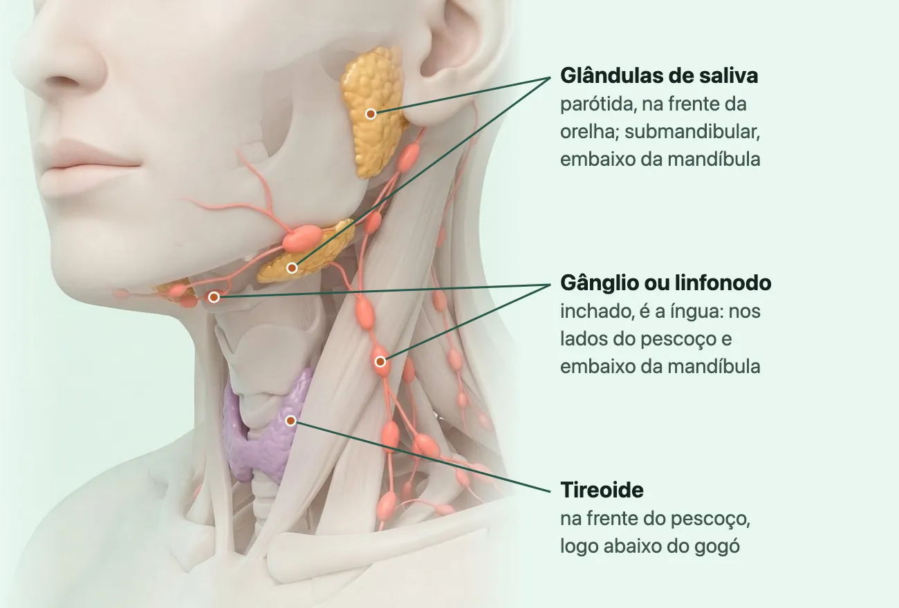 Desenho do pescoço de três quartos com a pele transparente: pequenos gânglios cor de coral embaixo da mandíbula e ao longo do lado do pescoço, duas glândulas de saliva amarelas, uma na frente da orelha e outra embaixo da mandíbula, e a tireoide violeta, em forma de borboleta, na frente do pescoço, logo abaixo do gogó.