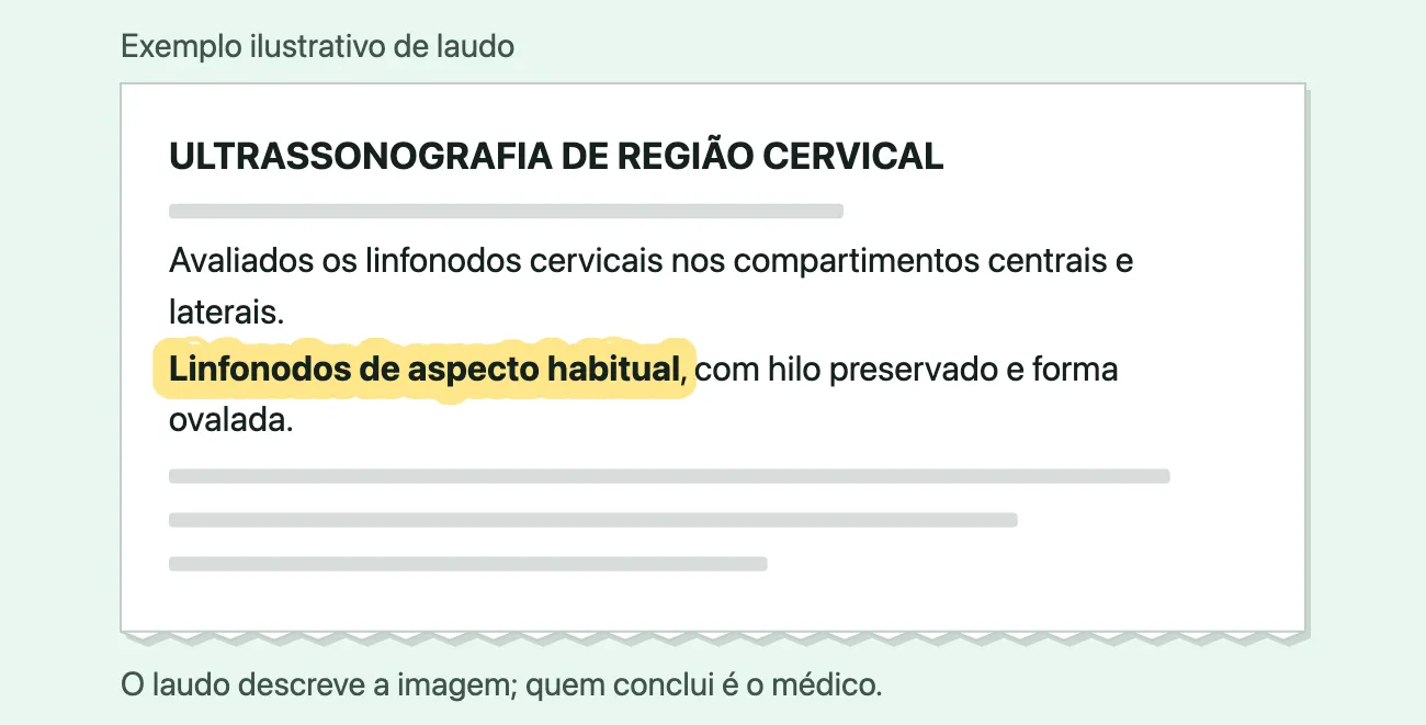 Exemplo ilustrativo de um trecho de laudo numa folha branca: o título "Ultrassonografia de região cervical", a linha "Avaliados os linfonodos cervicais nos compartimentos centrais e laterais" e a frase "Linfonodos de aspecto habitual, com hilo preservado e forma ovalada", com "Linfonodos de aspecto habitual" destacado em amarelo; o resto da folha aparece só como linhas cinzentas.