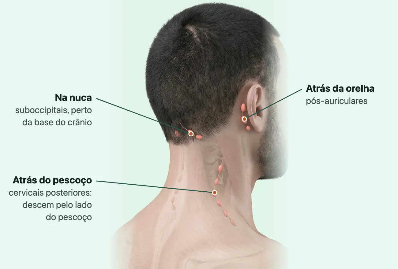 Desenho da cabeça e do pescoço vistos por trás, com os gânglios em coral na nuca junto à linha do cabelo, logo atrás da orelha e numa fileira que desce pelo lado do pescoço até o ombro.