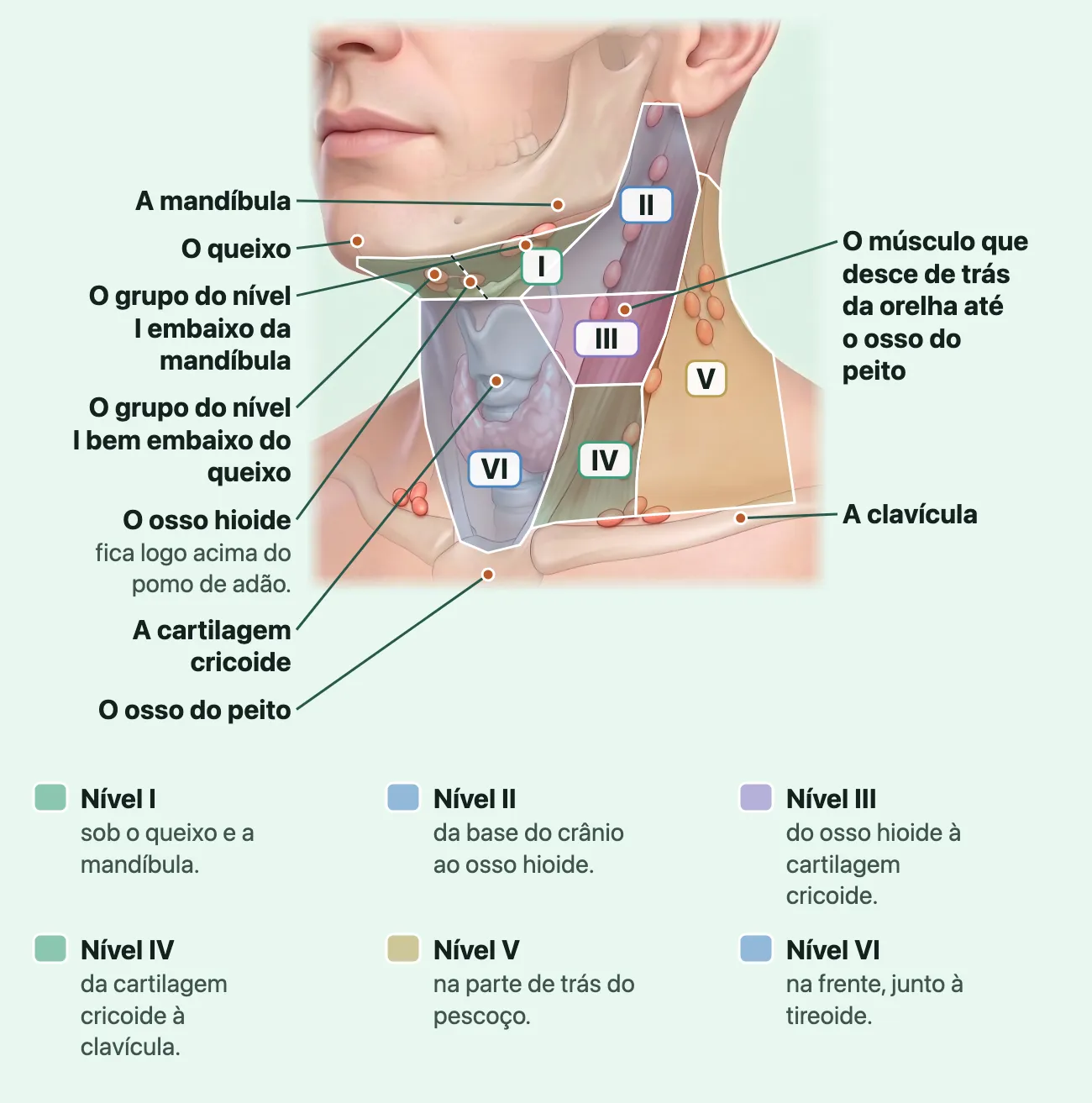 Desenho do pescoço de três quartos, com a pele transparente, coberto por seis faixas coloridas numeradas: o nível I sob o queixo e a mandíbula, dividido entre o grupo bem embaixo do queixo e o grupo embaixo da mandíbula; o II da base do crânio ao osso hioide; o III do hioide à cartilagem cricoide; o IV da cricoide à clavícula; o V na parte de trás do pescoço; o VI na frente, junto à tireoide.