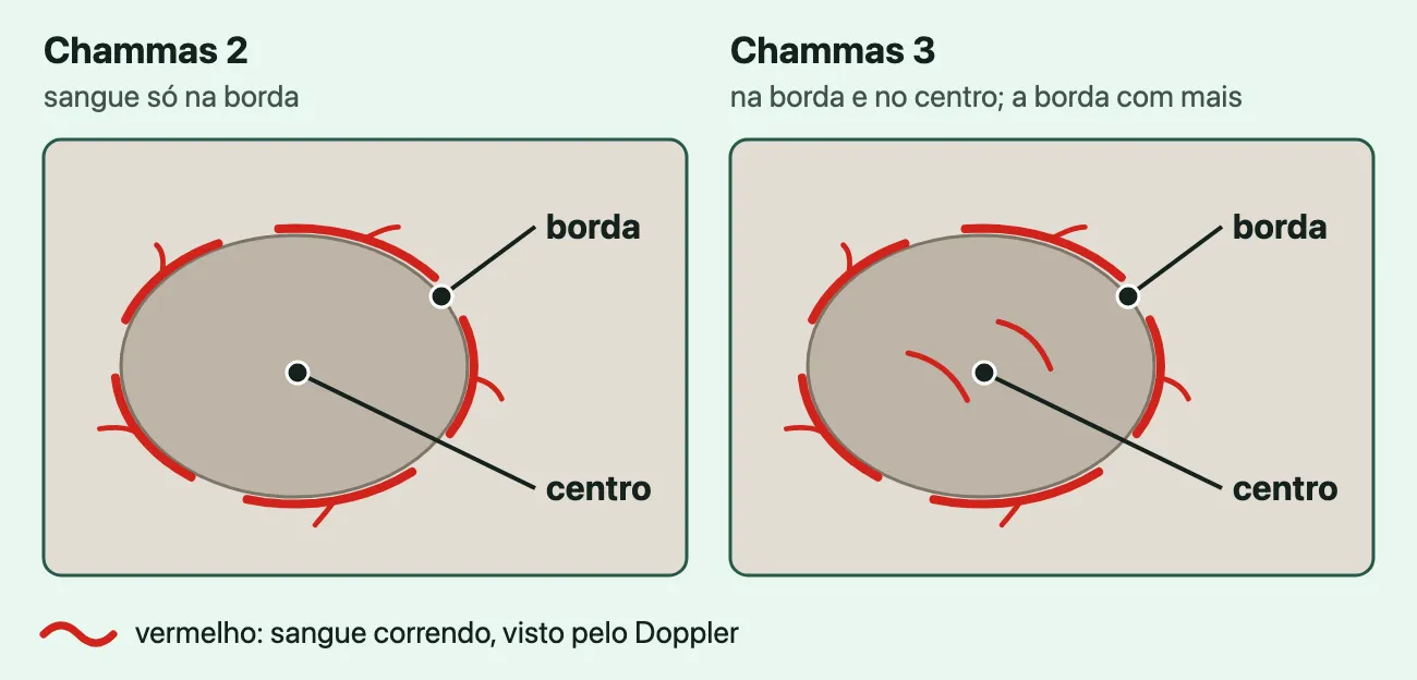 Dois nódulos desenhados lado a lado: no Chammas 2, vasos vermelhos só na borda; no Chammas 3, vasos na borda e alguns no centro, mais na borda.