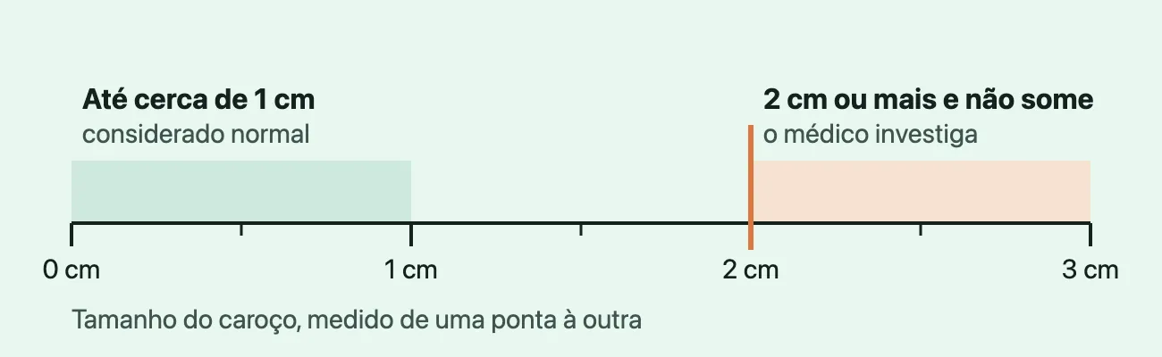 Régua de 0 a 3 centímetros: uma faixa verde até 1 cm, marcada "considerado normal", e uma linha laranja em 2 cm, marcada "2 cm ou mais e não some: o médico investiga".