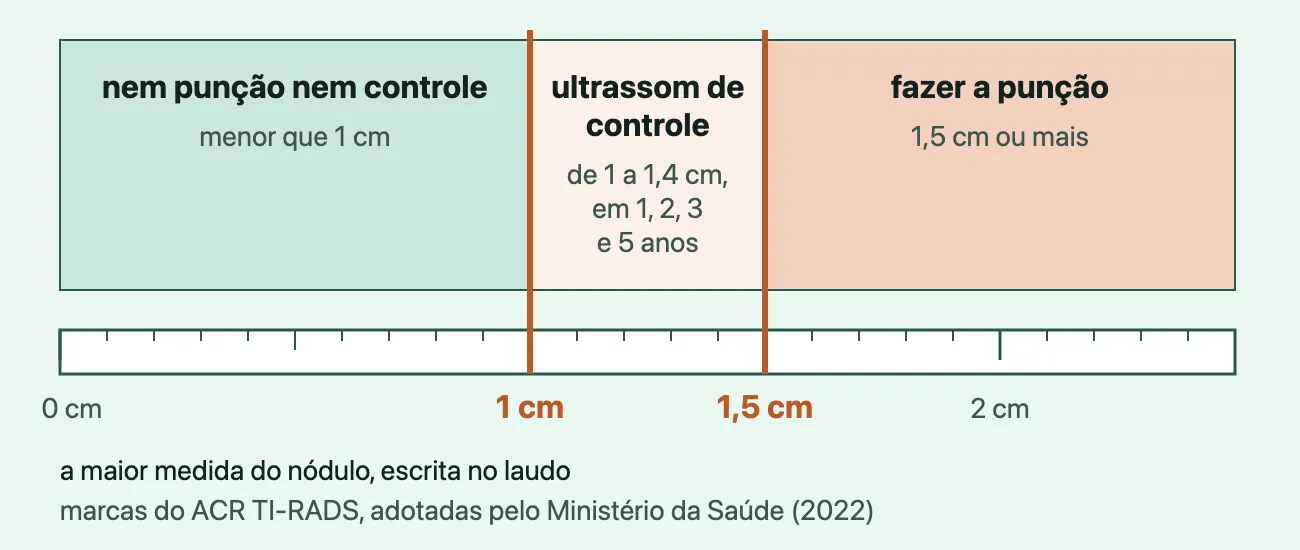 Régua de tamanho do nódulo de 0 a 2,5 cm com marcas em 1 cm e 1,5 cm: abaixo de 1 cm nem punção nem controle, de 1 a 1,4 cm ultrassom de controle, a partir de 1,5 cm punção.