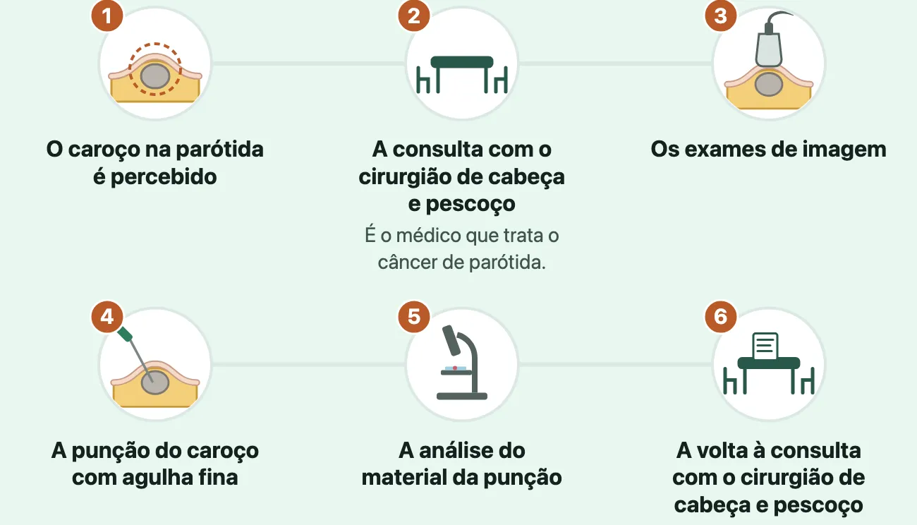 Seis etapas em discos ligados por uma linha: o caroço sob a pele; a consulta, desenhada como uma mesa com duas cadeiras; o ultrassom encostado na pele sobre o caroço; a agulha fina com a ponta dentro do caroço, na glândula; o microscópio com uma lâmina; e a volta à consulta, a mesa com uma folha de resultado.