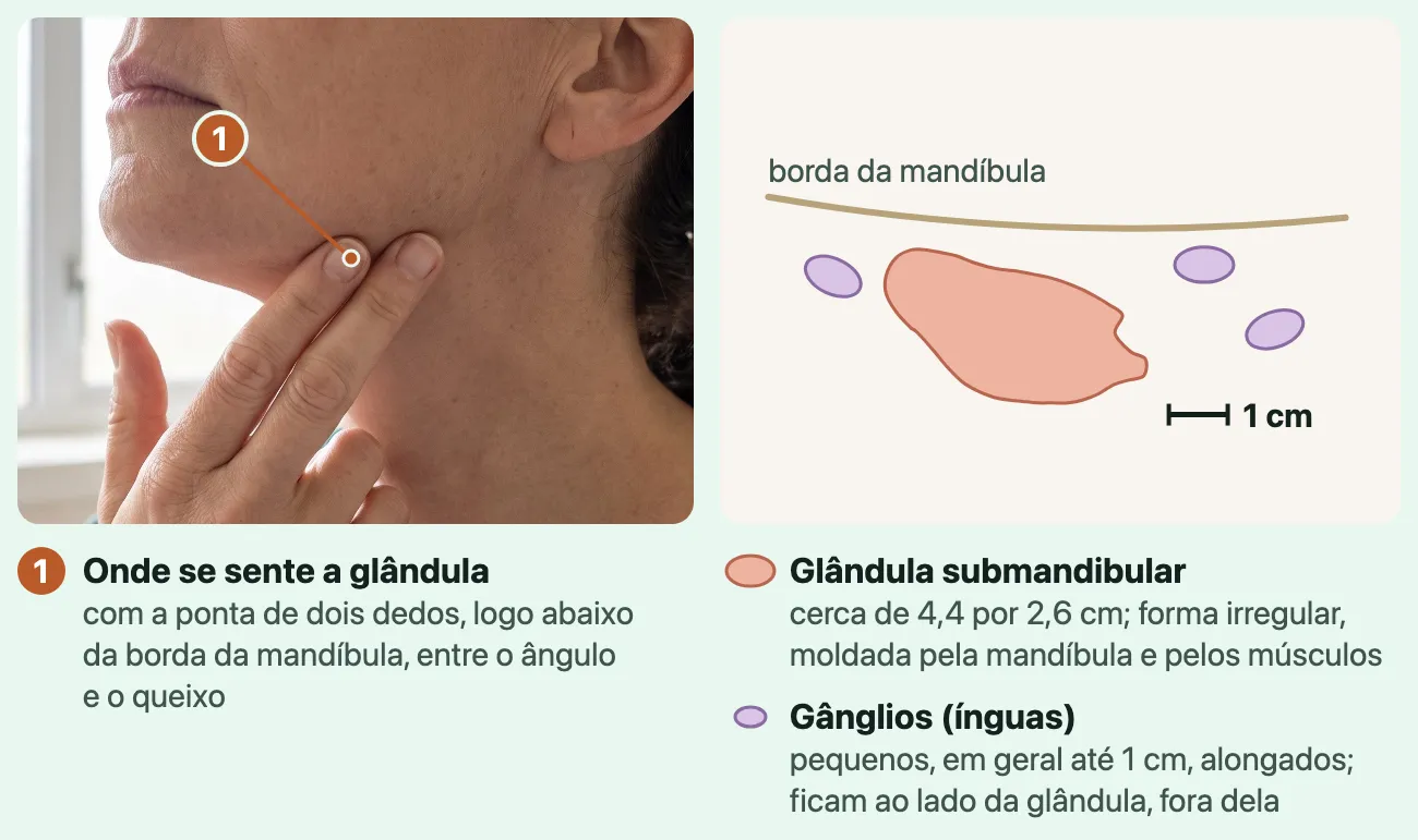 À esquerda, uma mulher de perfil aperta com a ponta de dois dedos a pele logo abaixo da mandíbula; à direita, um desenho na mesma escala da glândula submandibular, maior e irregular, embaixo da borda da mandíbula, e de três gânglios pequenos e alongados ao lado dela.