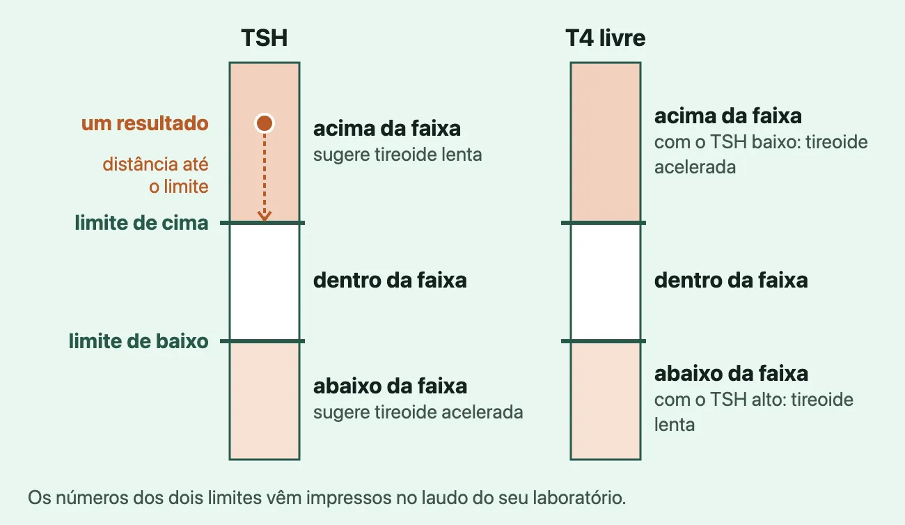 Duas barras em pé, uma do TSH e outra do T4 livre, cada uma dividida em acima da faixa, dentro da faixa e abaixo da faixa do laudo; no TSH, acima sugere tireoide lenta e abaixo tireoide acelerada; no T4 livre, o contrário; um ponto de exemplo acima da faixa do TSH mostra a distância até o limite.