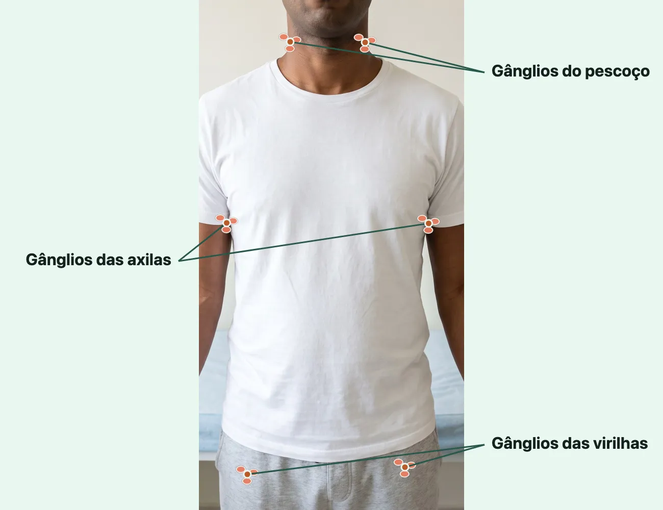 Foto de um homem em pé num consultório, de camiseta branca, do queixo às coxas, sem os olhos, com pequenos círculos cor de coral marcando os gânglios dos dois lados do pescoço, nas duas axilas e nas duas virilhas.