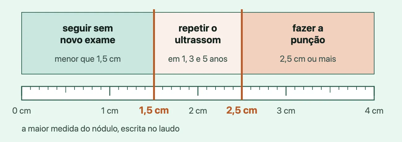 Uma régua de 0 a 4 cm, "a maior medida do nódulo, escrita no laudo", com dois traços terracota, em 1,5 cm e em 2,5 cm, que a dividem em três faixas: "seguir sem novo exame", "menor que 1,5 cm"; "repetir o ultrassom", "em 1, 3 e 5 anos"; e "fazer a punção", "2,5 cm ou mais".