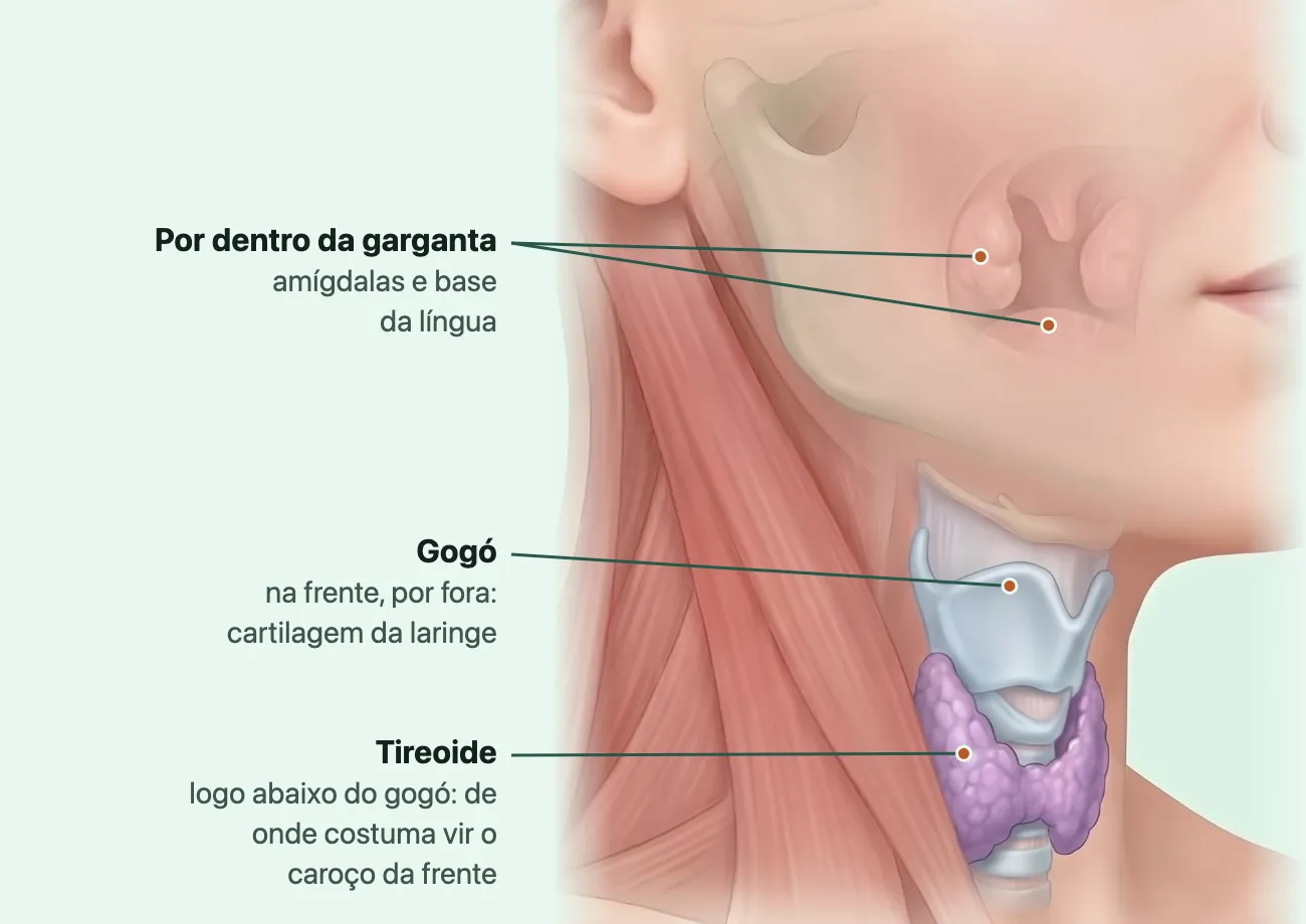 Desenho da parte de baixo do rosto e do pescoço de três quartos, com a pele transparente: atrás da boca, as amígdalas e a base da língua em rosa claro; na frente do pescoço, a laringe cinza-azulada com o gogó e, logo abaixo, a tireoide violeta em forma de borboleta.