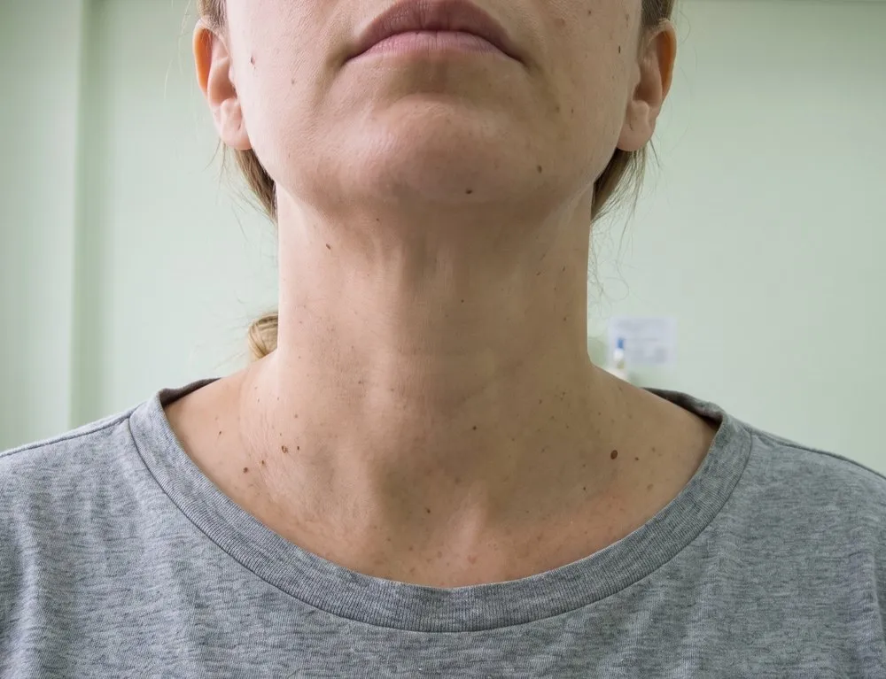 O pescoço de uma mulher visto de frente, do queixo ao alto do peito: a linha da frente do pescoço desce reta até a base, sem nenhum volume.