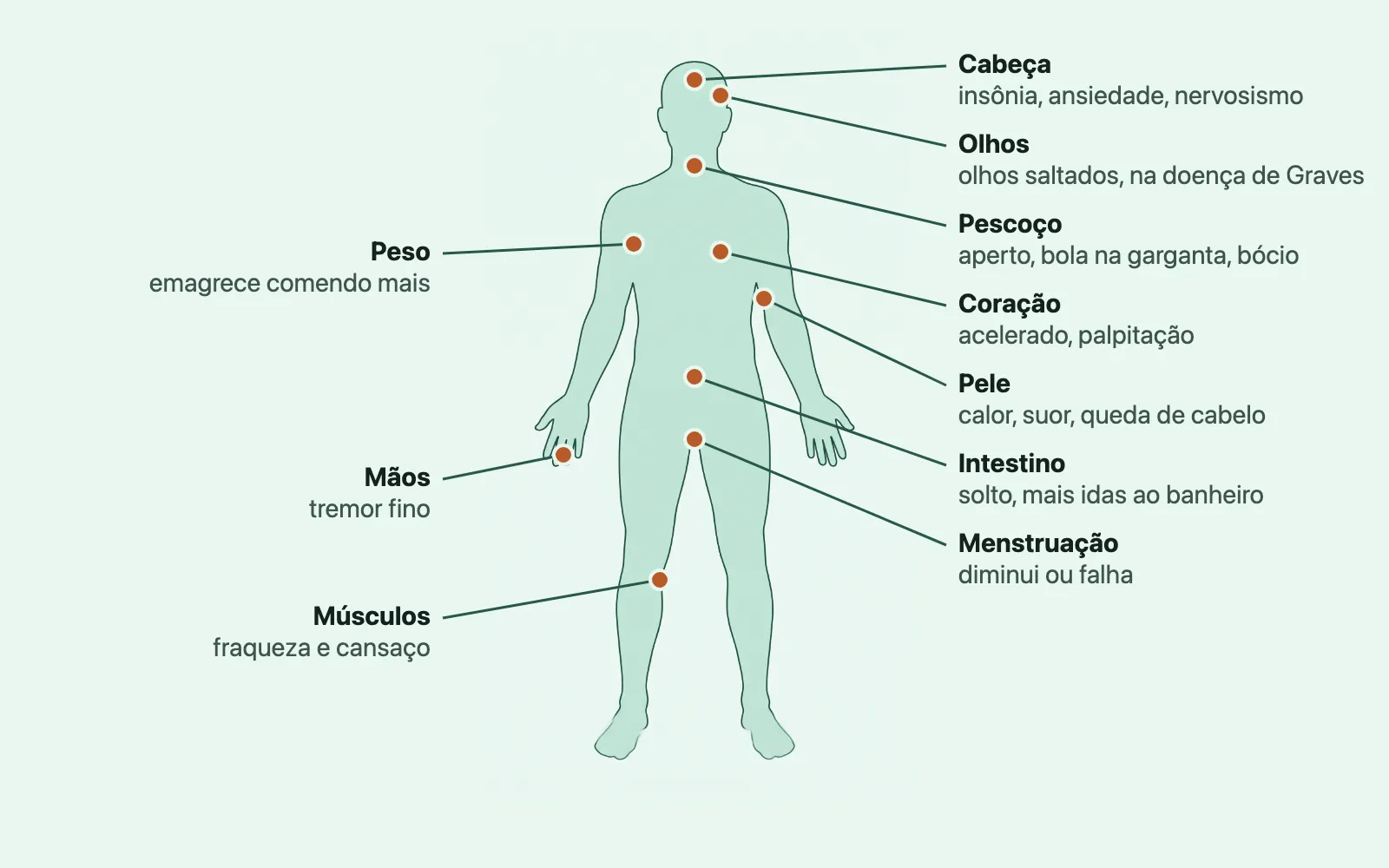 A silhueta de um corpo de frente, com dez pontos marcados e ligados por fios a rótulos ao redor: cabeça (insônia, ansiedade, nervosismo), olhos (olhos saltados, na doença de Graves), pescoço (aperto, bola na garganta, bócio), coração (acelerado, palpitação), pele (calor, suor, queda de cabelo), intestino (solto, mais idas ao banheiro), menstruação (diminui ou falha), peso (emagrece comendo mais), mãos (tremor fino) e músculos (fraqueza e cansaço).