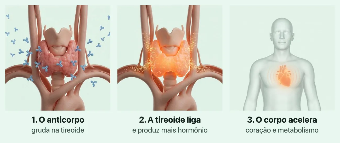 Três quadros numerados. No primeiro, 1. O anticorpo gruda na tireoide: a glândula rosada em forma de borboleta com pequenos anticorpos azuis em forma de Y presos à sua superfície. No segundo, 2. A tireoide liga e produz mais hormônio: a tireoide no pescoço, em volta da traqueia, acesa em laranja e soltando pontos de luz nos vasos ao redor. No terceiro, 3. O corpo acelera, coração e metabolismo: o tronco de uma pessoa com o coração aceso em laranja no peito, cercado de ondas de batimento.